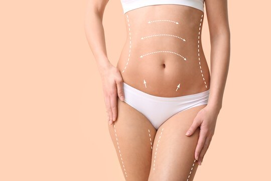 Liposuction with Local vs General Anesthesia: What to Expect